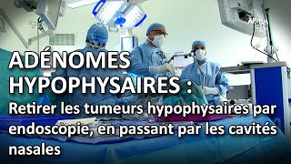 Adénomes hypophysaires : retirer les tumeurs hypophysaires en passant par les cavités nasales