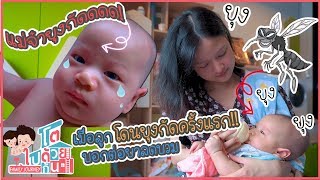 เมื่อลูกโดนยุงกัดครั้งแรก!! ตุ่ม แดง บวม เป่ง ต้องทายาแก้บวม | โตไปด้วยกัน Family Journey