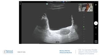 M8 Elite Zoom, Color and Power Doppler on Ovaries Training Video Demonstration