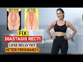 FIX MOMMY BELLY - 2 WEEKS (DO THIS EVERYDAY!) | How to Lose Belly Fat After Pregnancy | GymNought