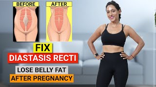 FIX MOMMY BELLY - 2 WEEKS (DO THIS EVERYDAY!) | How to Lose Belly Fat After Pregnancy | GymNought