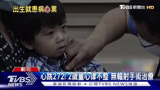 心跳272! 2歲童心律不整 無輻射手術治療