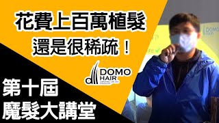 10th魔髮大講堂 花費上百萬植髮，還是很稀疏 DOMO HAIR髮量最實在!｜魔髮部屋