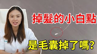 【脫髮掉髮】掉髮的小白點是毛囊掉了嗎？保持清潔對頭皮很重要！