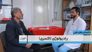 رادیولوژی (اکسری) _ دانستنی های طبی _  1400.9.17