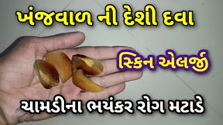 ખંજવાળ ની દેશી દવા || ચામડીના ભયંકર રોગો મટાડે આ ફળના બીજ || સ્કિન એલર્જી || खुजली के घरेलू उपचार