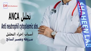 معلومات هامة عن تحليل ASCA