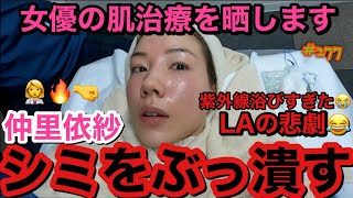 女優の肌治療👩‍⚕️シミをぶっ潰しに行ったけどこの女はどんな時でもふざけ出すのは誰遺伝？