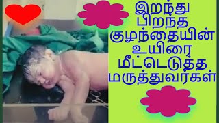 😍இறந்து பிறந்த குழந்தையின் உயிரை மீட்டெடுத்த மருத்துவர்கள்|#medical|#humanity|#viralvideo | #jailer