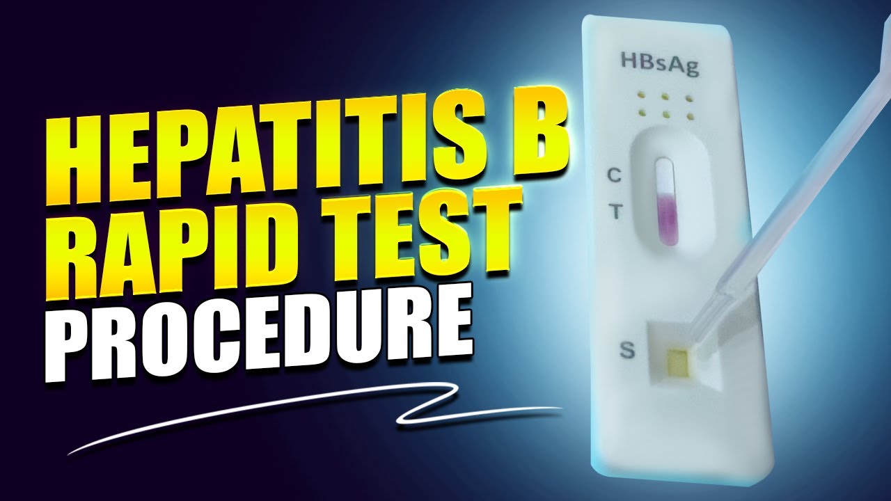 Hepatitis B Rapid Test | Surface Antigen Test | Practical - YouTube