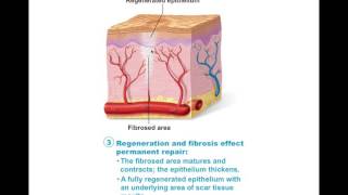 Chapter 4.7 Tissue Repair BIO201