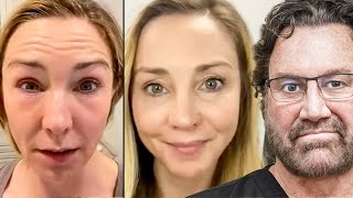 My CO2 Laser Experience: Post-Treatment Transformation | Surgeon Reacts