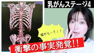 【乳がん骨転移】余命宣告から2年半後のCT結果は...？！:::【Breast Cancer】See difference in bone before/after CT!! :::