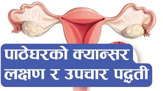 patheghar ko cancer पाठेघरको क्यान्सर भएको कसरी थाहा पाउने Nepali Health Tips