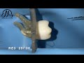 race evo rotary system for management of multiplanar root canal curvatures educational demo video