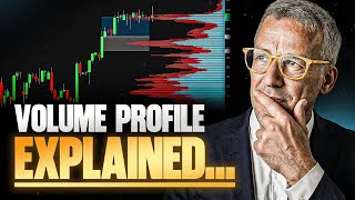 The ONLY Volume-Profile-Video you will EVER need (Trading World Champion reveals)