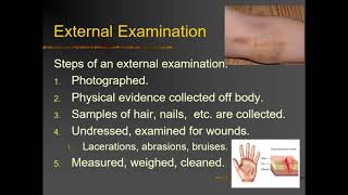 Forensic Autopsy Video Lecture