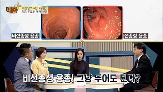 대장암의 씨앗 ‘용종’ 무조선 제거하라! [내 몸 플러스] 81회 20171126