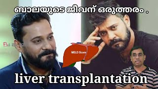 ബാലയുടെ ജീവന് ഒരുത്തരം .liver transplantation#bala actor latest news