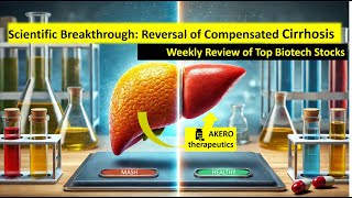 Cirrhosis vs AKERO Therapy. + Weekly Top Biotech Stocks Analysis $AKRO $SLXN $SLS. ENGLISH