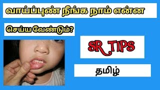 வாய்ப்புண் குணமாக நாம் என்ன செய்ய வேண்டும்? | SR TIPS