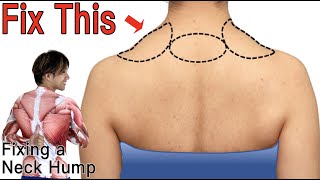 7mins!! Burn Back Fat \u0026 Improve Posture Fast!!🔥 Easy Home Workout To Get Slim Back \u0026 Arm