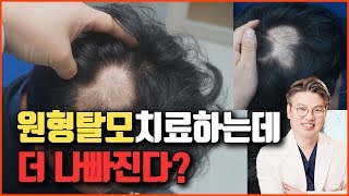 원형탈모 치료하는데 더 나빠진다?