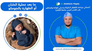 #الختان كيفية العناية بالطفل بعد عملية الختان أو الطهاره بالجومكو - الدكتور عبدالعزيز مجدي عبدالعزيز