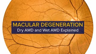 Macular Degeneration: Diagnosis, Symptoms & Treatment of Dry and Wet AMD | UC Davis Health
