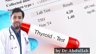 Thyroid Profile | Thyroid Test | Thyroid Function Test | TSH | T3 & T4 | How to read thyroid report?