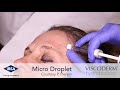 viscoderm hydrobooster microdroplet technique forehead area