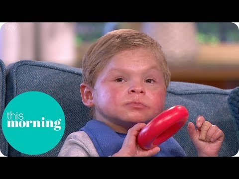 The 13-Year-Old Trapped in a Toddler's Body | This Morning The 13-Year-Old Trapped in a Toddler's Body | This Morning