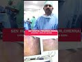 பித்தப்பை கல் அகற்றும் ஆபரேஷன் 20 நிமிடத்தில் gallstone removal operation