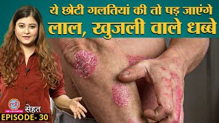 Skin पर होने वाली खतरनाक बीमारी Psoriasis क्यों होती है और इसका इलाज है क्या? | Sehat Ep 30