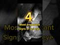 Most important signs of evil eye..#islamicshorts #islamicvideo #evileye #viral #signs