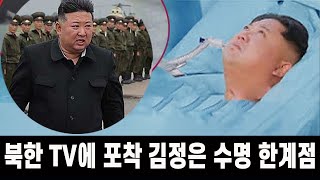 [특종] 북한 TV에 포착된 김정은 기대 수명 한계점