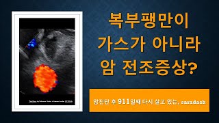 복부 팽만이 가스가 아니라 암 전조증상이라고?_내가 느낀 암 전조증상_911 Days