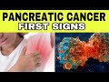 7 Early Signs of PANCREATIC CANCER (Symptoms of Insulinoma)