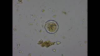 From my garden soil a testate amoeba actively feeding.