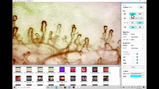 アタッチメントを使用した手指先血流の観察方法