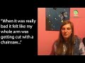 how selina overcame crps with peripheral nerve surgery