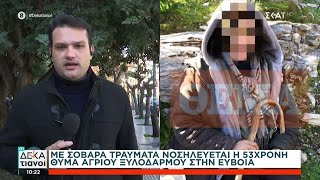 Με σοβαρά τραύματα νοσηλεύεται η 53χρονη θύμα άγριου ξυλοδαρμού στην Εύβοια | 01/02/2025