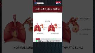 ఆస్తమా ఉంటే ఈ లక్షణాలు కనిపిస్తాయి | Dr.Kishan Srikanth @MedPlusONETV