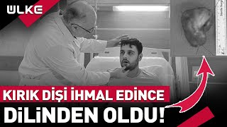 Kırık Dişini İhmal Etti Kanser Oldu