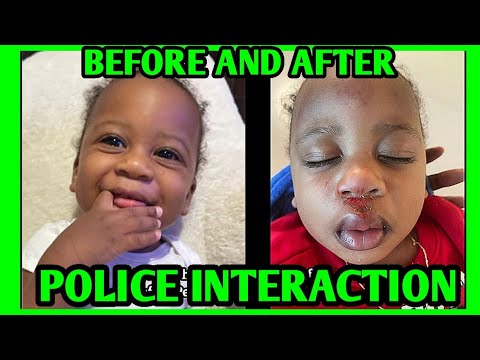 Baby Falls Out Of Police Car While In Police Custody - Pensacola ...