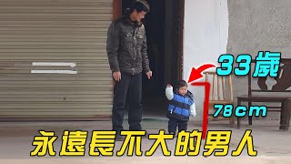 永遠不會變老的男人，33歲長得像3歲，身高只有78CM ｜不老癥｜明星觀察員