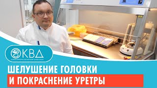 😯 Шелушение головки и покраснение уретры. Клинический случай №480