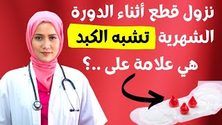 سبب نزول قطع تشبهه الكبده اثناء الدوره .ماذا يعني وجود كتل دم متجلطة أثناء الدورة الشهرية!؟