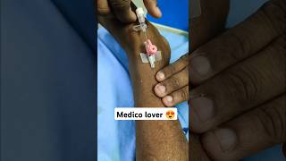 Intravenous cannula king 👑 #shorts #cannula #trending #youtubeshorts #mbbs #doctor #love #song