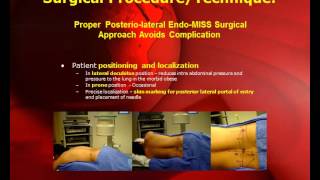Potential Complications and Avoidance in Endoscopic Transforaminal Lumbar Discectomy